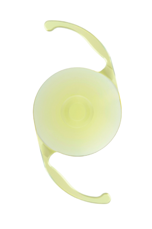 Representative AcrySof IQ Vivity intraocular lens
